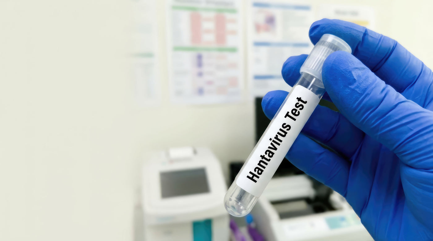 Hantavirus Testing: Why Proper Specimen Collection Matters