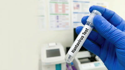 Hantavirus Testing: Why Proper Specimen Collection Matters
